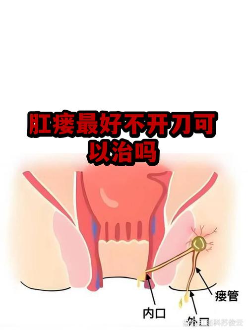 姆巴佩膝伤治疗方案曝光：优先保守治疗或手术备用