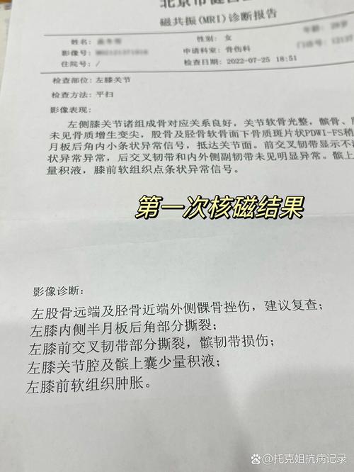 记者报道:加比亚接受磁共振检查,伤势无大碍