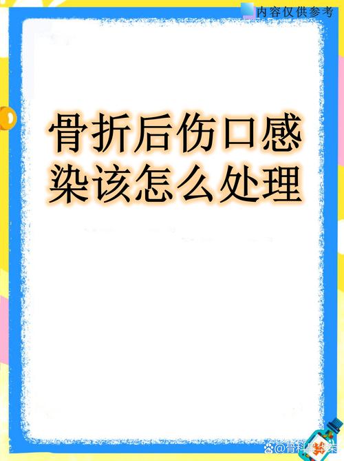 中场核心重伤！奇克牙齿牙槽骨双重骨折，恢复期达数月